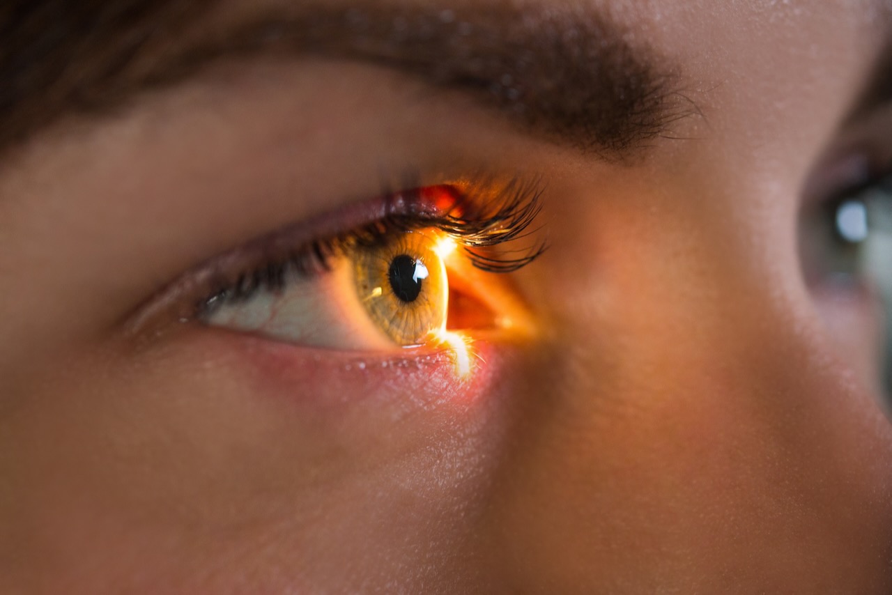 Glaucoma Awareness Month