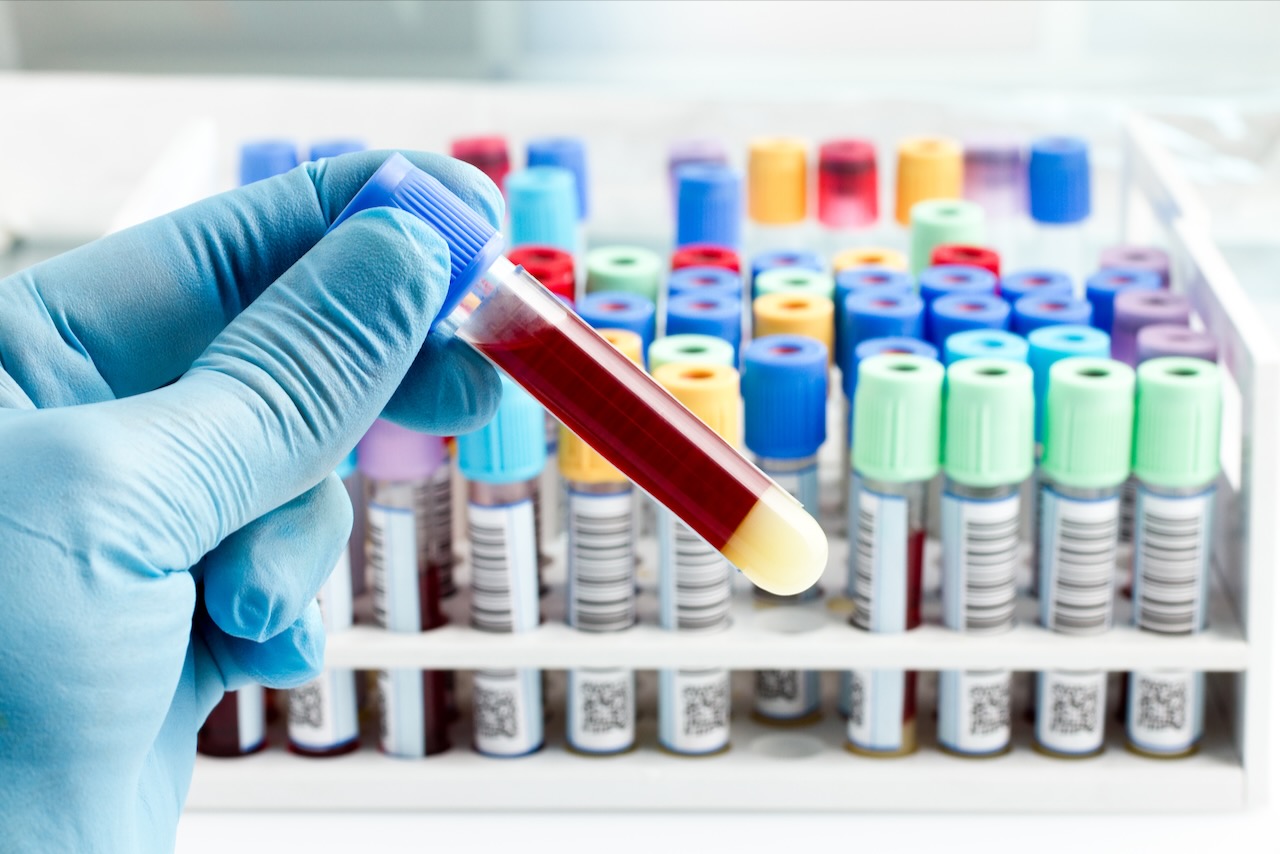 Patient Blood Management Week