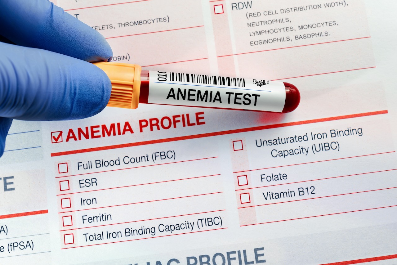 Living With Sickle Cell Anemia